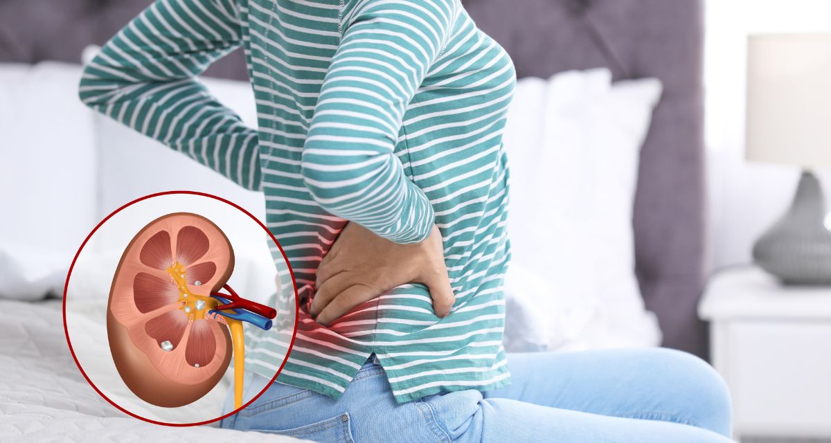 Kidney Stone? জেনে নিন কিডনিতে স্টোনের ৮টি স্পষ্ট লক্ষণ!