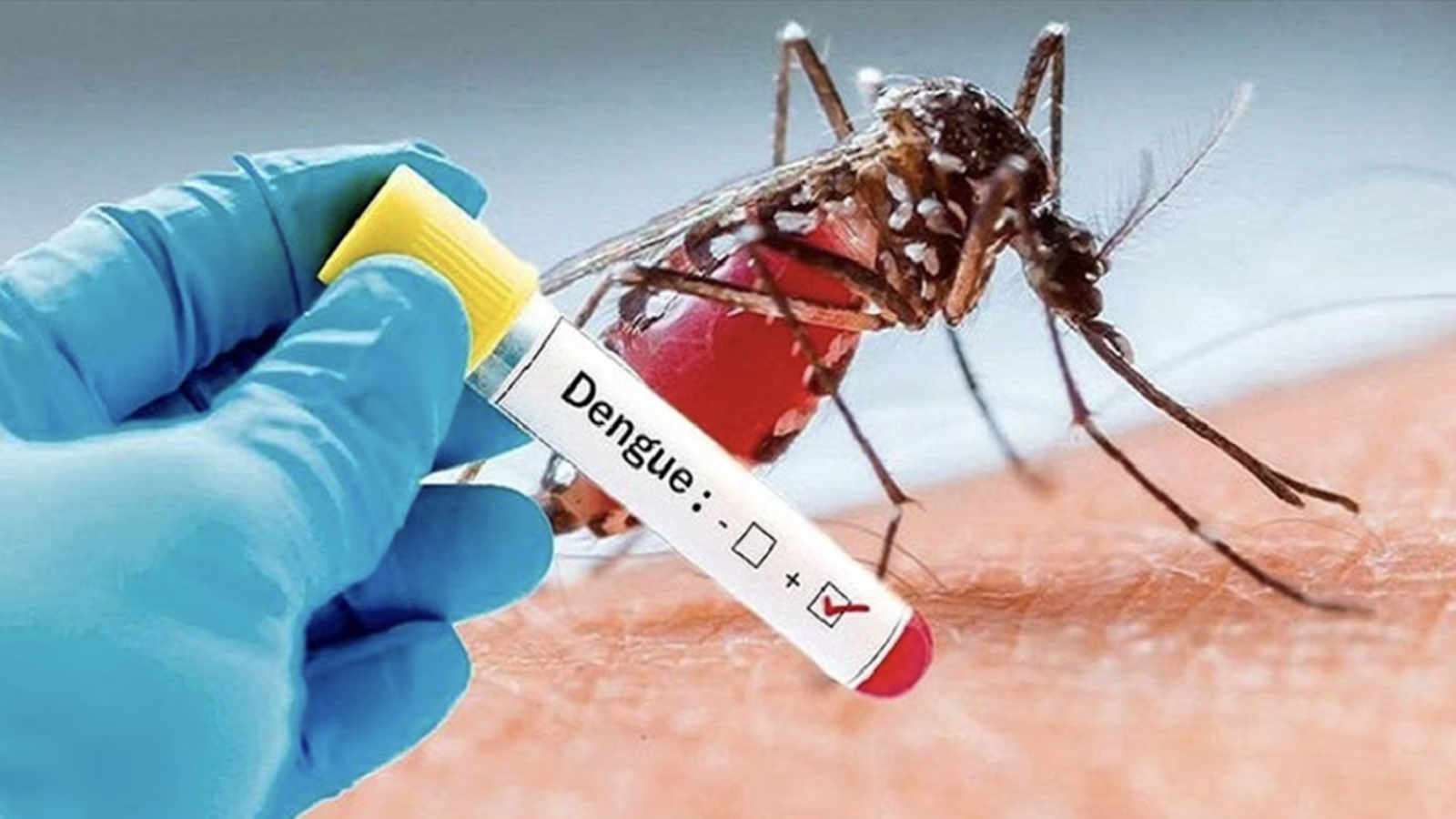 Dengue